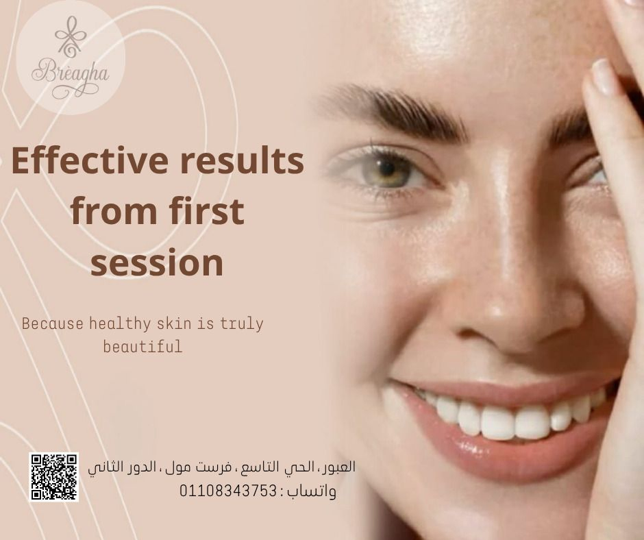علاج التصبغات وتوحيد لون البشرة - عيادة براجيا للتجميل والليزر